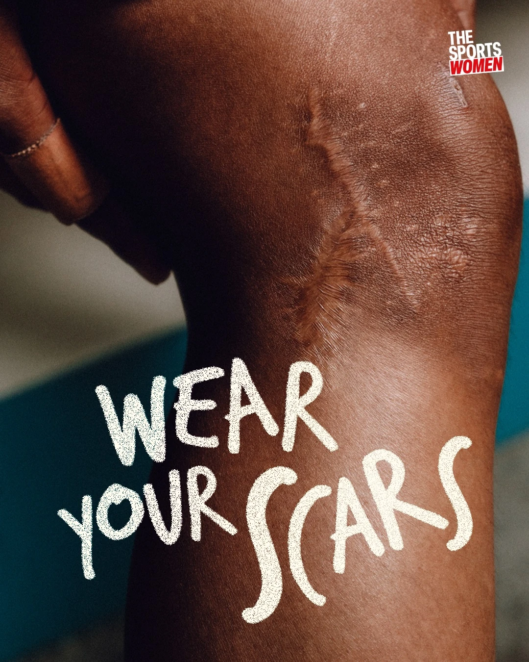 Wear Your Scars. ? image 1